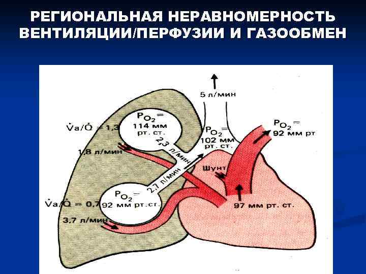 РЕГИОНАЛЬНАЯ НЕРАВНОМЕРНОСТЬ ВЕНТИЛЯЦИИ/ПЕРФУЗИИ И ГАЗООБМЕН 