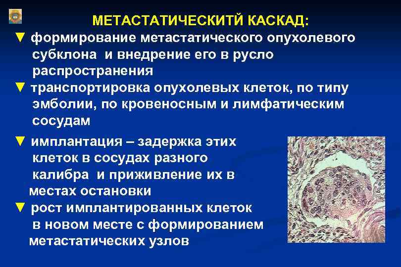 МЕТАСТАТИЧЕСКИТЙ КАСКАД: ▼ формирование метастатического опухолевого субклона и внедрение его в русло распространения ▼