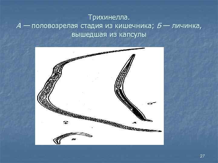 Трихинелла. А — половозрелая стадия из кишечника; Б — личинка, вышедшая из капсулы 27