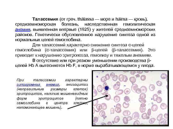 Талассемия что это. Талассемия картина крови. Талассемия изменения в ОАК. Талассемия картина крови периферической. Картинамкрови при телассемии.