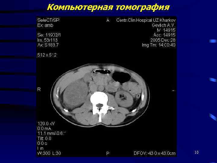 Компьютерная томография 10 