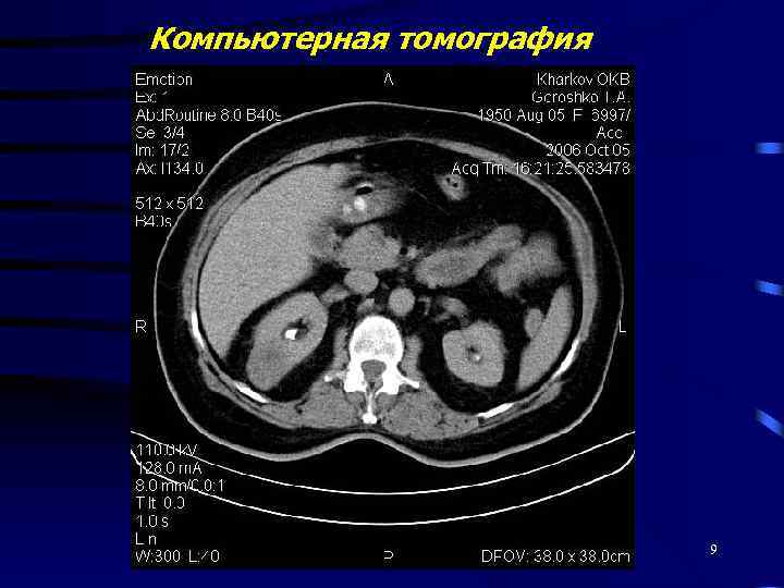 Компьютерная томография 9 
