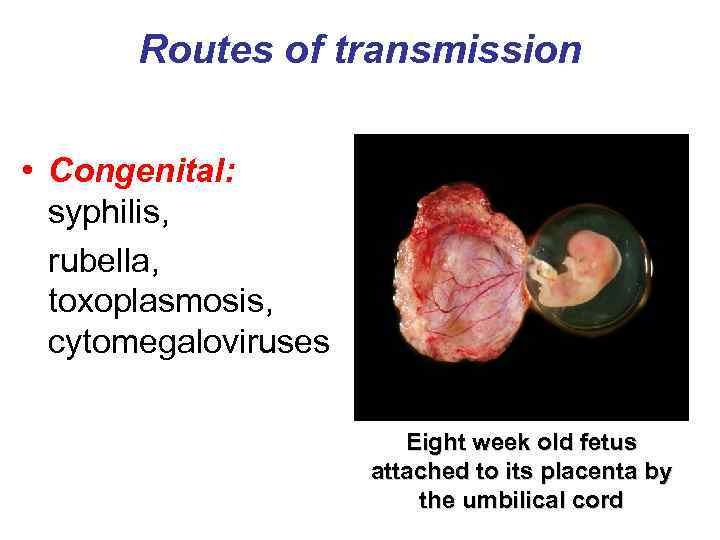 Routes of transmission • Congenital: syphilis, rubella, toxoplasmosis, cytomegaloviruses Eight week old fetus attached