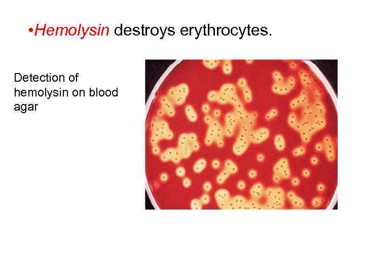  • Hemolysin destroys erythrocytes. Detection of hemolysin on blood agar 