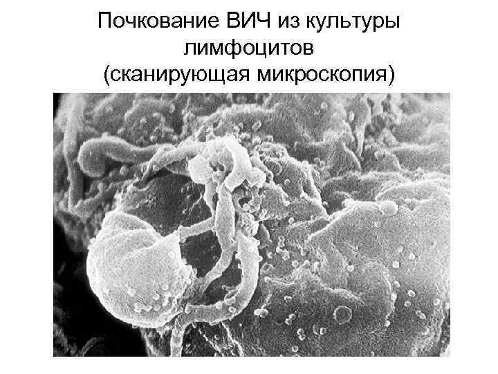 Почкование ВИЧ из культуры лимфоцитов (сканирующая микроскопия) 