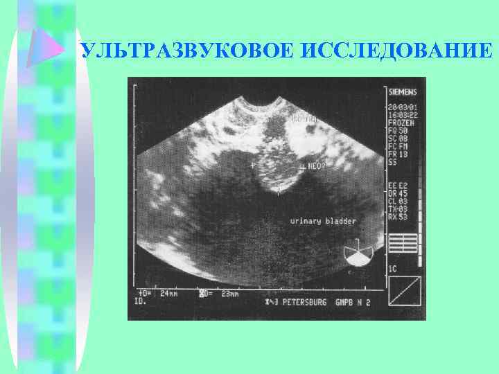 УЛЬТРАЗВУКОВОЕ ИССЛЕДОВАНИЕ 