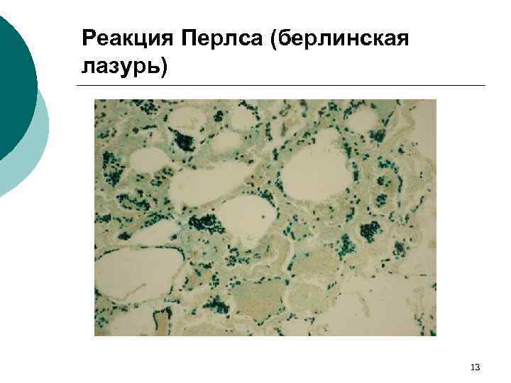 Реакция Перлса (берлинская лазурь) 13 