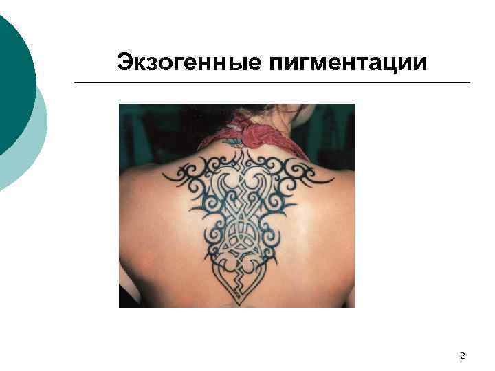 Экзогенные пигментации 2 