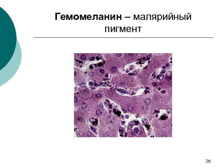 Гемомеланин – малярийный пигмент 26 