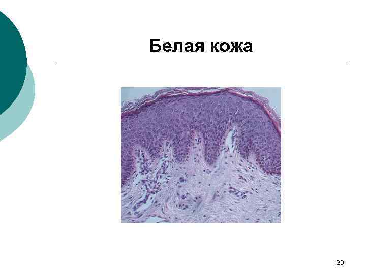 Белая кожа 30 