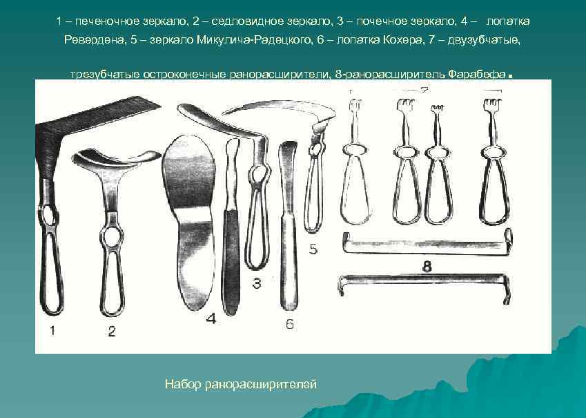  1 – печеночное зеркало, 2 – седловидное зеркало, 3 – почечное зеркало, 4