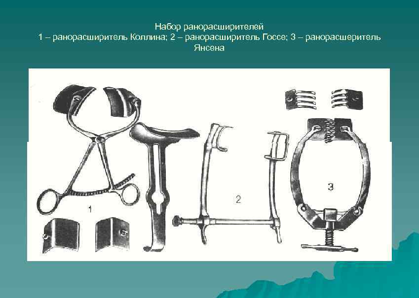 Набор ранорасширителей 1 – ранорасширитель Коллина; 2 – ранорасширитель Госсе; 3 – ранорасшеритель Янсена