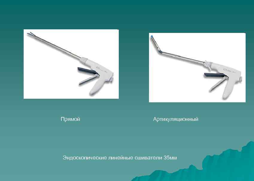 Прямой Артикуляционный Эндоскопические линейные сшиватели 35 мм 