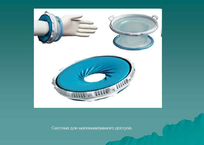 Система для малоинвазивного доступа. 