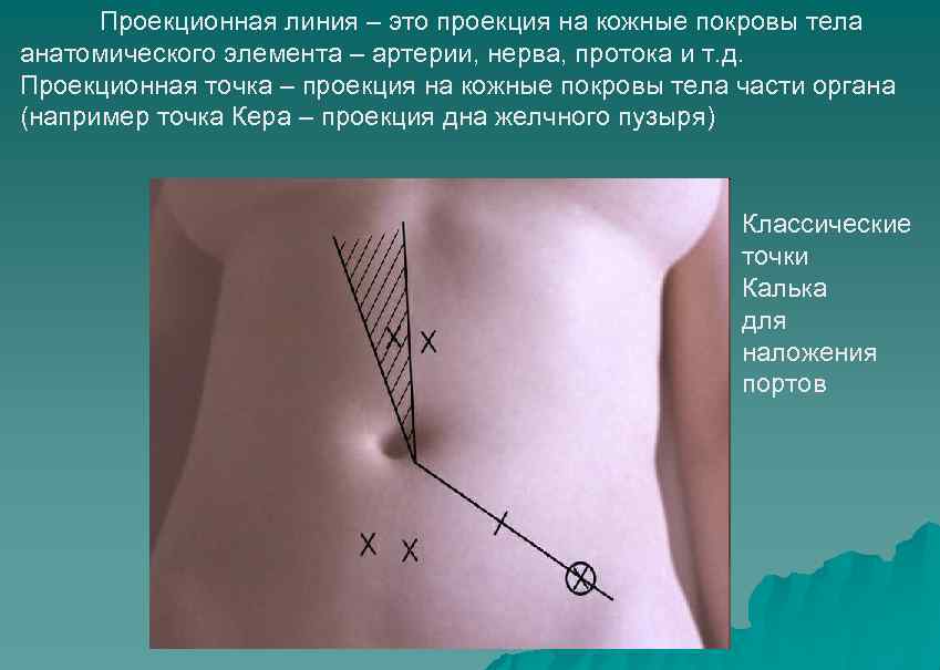 Проекционная линия – это проекция на кожные покровы тела анатомического элемента – артерии, нерва,