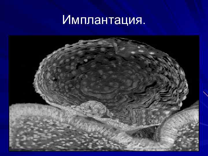 Имплантация эмбриона. Имплантация онтогенез. Имплантация зародыша в матке. Имплантация бластоцисты. Имплантация бластоцисты в матку.