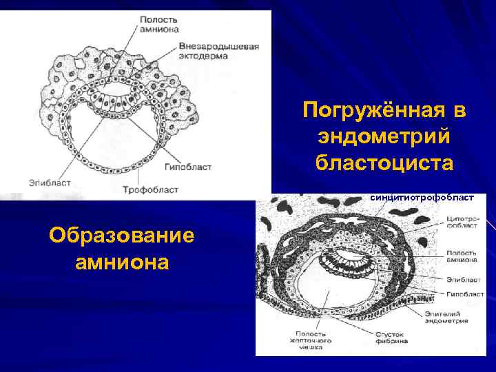 Трофобласт это. Бластоциста эпибласт. Бластоциста человека гистология. Трофобласт синцитиотрофобласт. Бластоциста зародышевый диск.