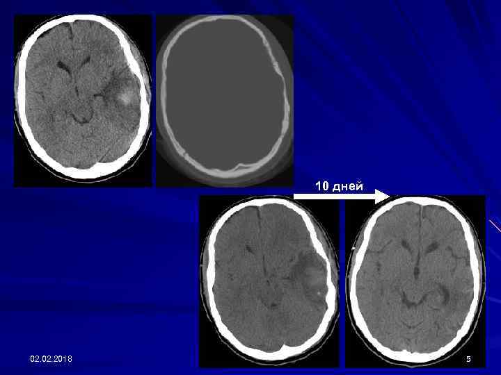 10 дней 02. 2018 5 