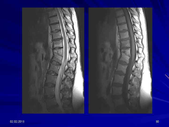 02. 2018 50 