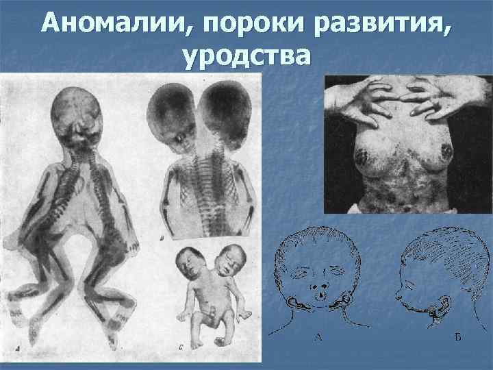Аномалии, пороки развития, уродства 