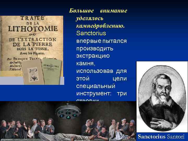 Большое внимание уделялось камнедроблению. Sanctorius впервые пытался производить экстракцию камня, использовав для этой цели