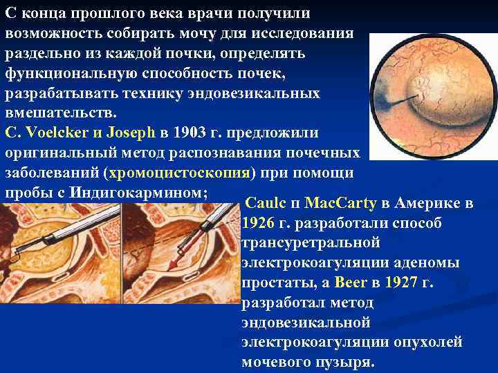 С конца прошлого века врачи получили возможность собирать мочу для исследования раздельно из каждой