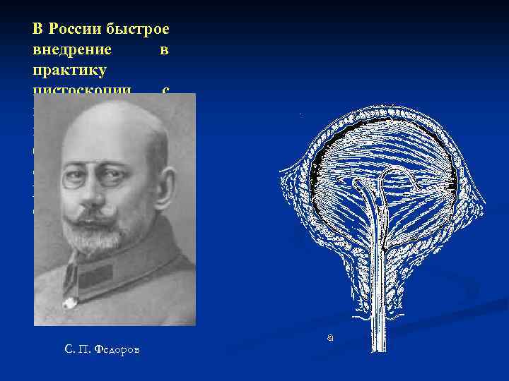 В России быстрое внедрение в практику цистоскопии с катетеризацией мочеточника было осуществлено М. Л.