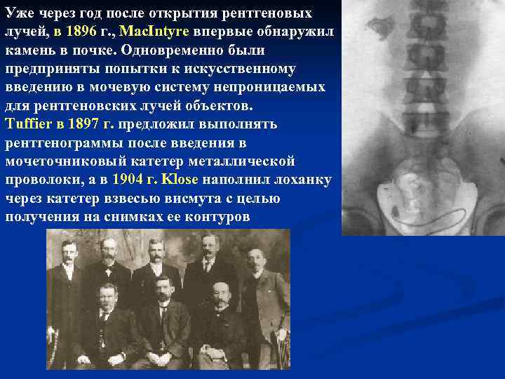 Уже через год после открытия рентгеновых лучей, в 1896 г. , Mac. Intyre впервые