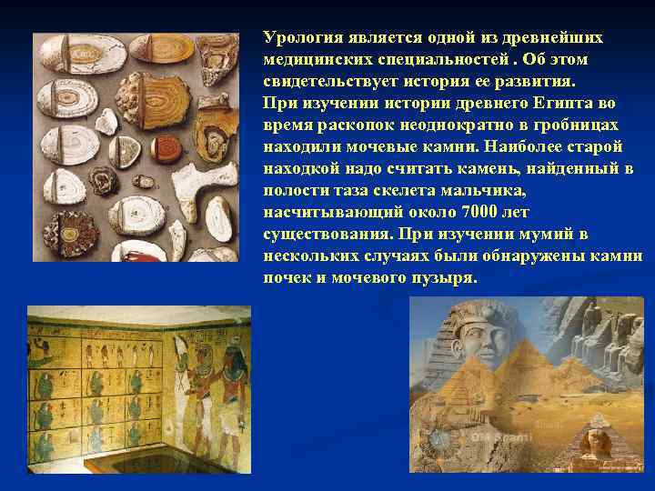 Урология является одной из древнейших медицинских специальностей. Об этом свидетельствует история ее развития. При