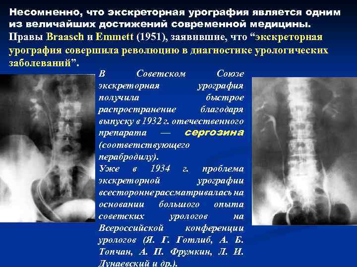 Несомненно, что экскреторная урография является одним из величайших достижений современной медицины. Правы Braasch и