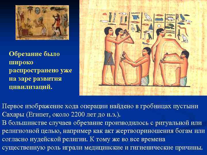 Обрезание было широко распространено уже на заре развития цивилизаций. Первое изображение хода операции найдено