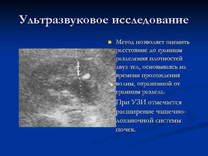 Ультразвуковое исследование n Метод позволяет оценить расстояние до границы разделения плотностей двух тел, основываясь