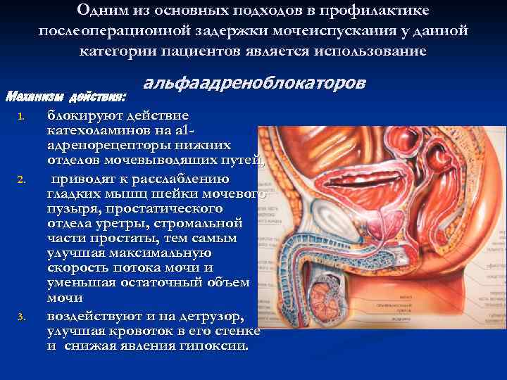 Одним из основных подходов в профилактике послеоперационной задержки мочеиспускания у данной категории пациентов является
