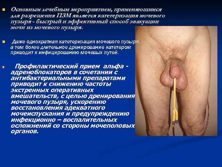 n Основным лечебным мероприятием, применяющимся для разрешения ПЗМ является катетеризация мочевого пузыря - быстрый