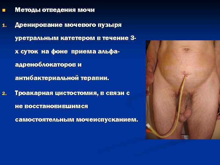 n Методы отведения мочи 1. Дренирование мочевого пузыря уретральным катетером в течение 3 х