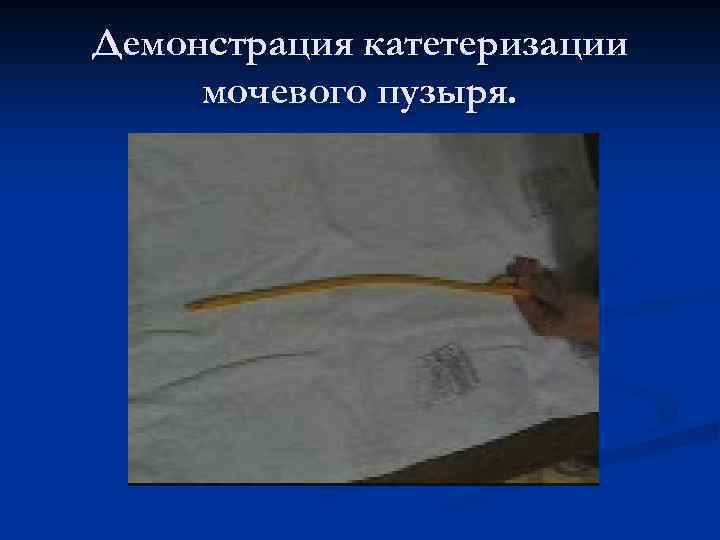 Демонстрация катетеризации мочевого пузыря. 