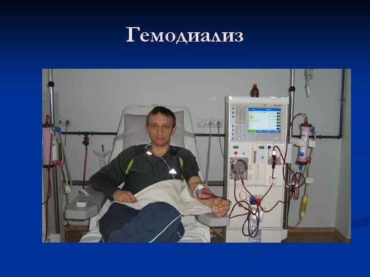 Гемодиализ 