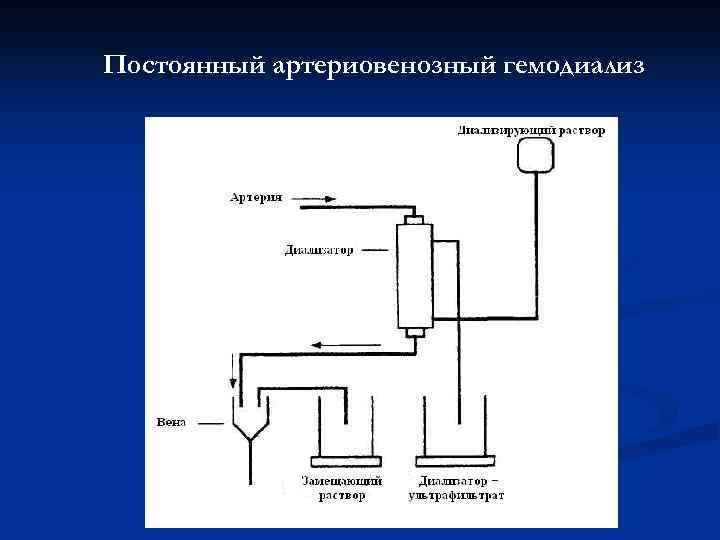 Постоянный артериовенозный гемодиализ 