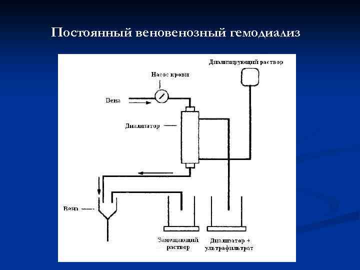 Постоянный венозный гемодиализ 