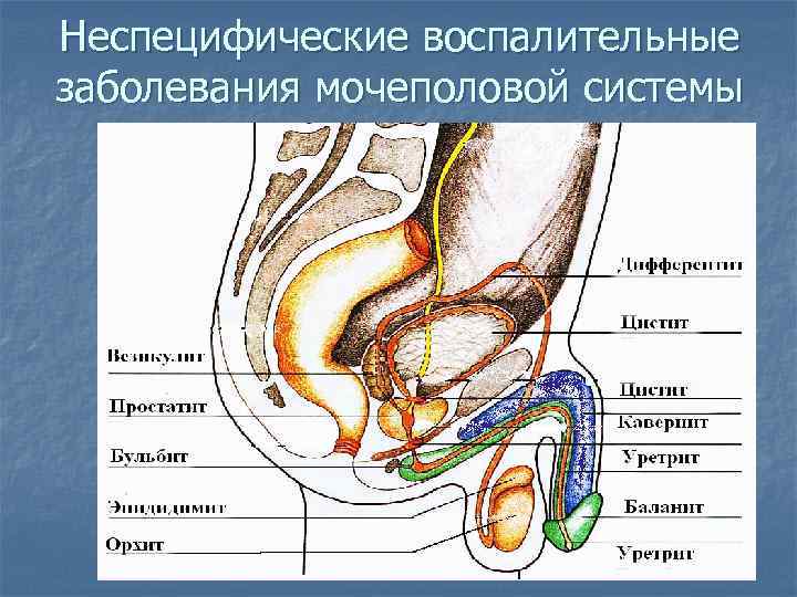 Неспецифические воспалительные заболевания мочеполовой системы 