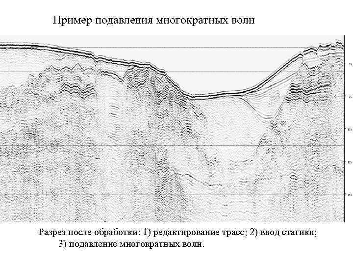 Пример подавления многократных волн Разрез после обработки: 1) редактирование трасс; 2) ввод статики; Необработанный