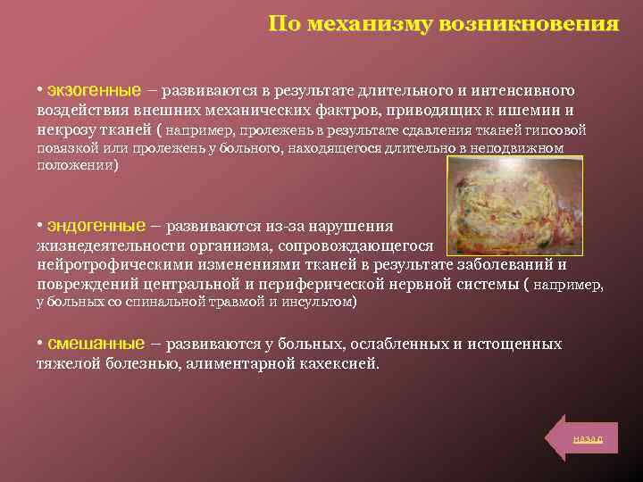 По механизму возникновения • экзогенные – развиваются в результате длительного и интенсивного воздействия внешних