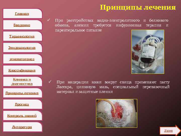 Принципы лечения Главная ü Введение При расстройствах водно-электролитного и белкового обмена, анемии требуется инфузионная
