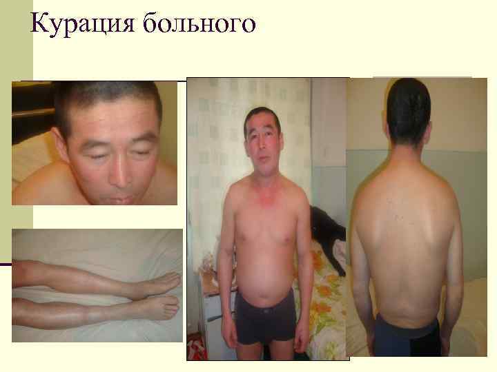 Курация больного 