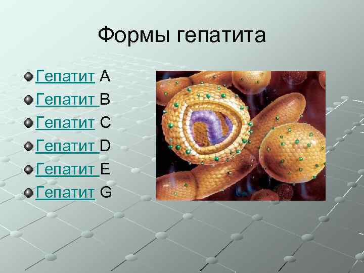 Формы гепатита Гепатит А Гепатит В Гепатит С Гепатит D Гепатит Е Гепатит G