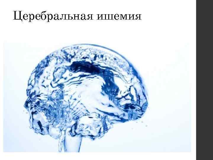 Церебральная ишемия 
