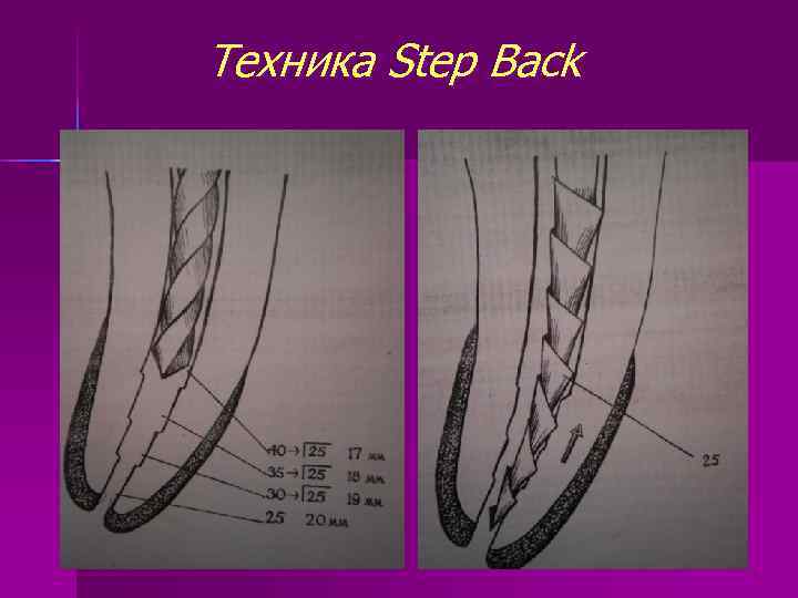 Техника Step Back 