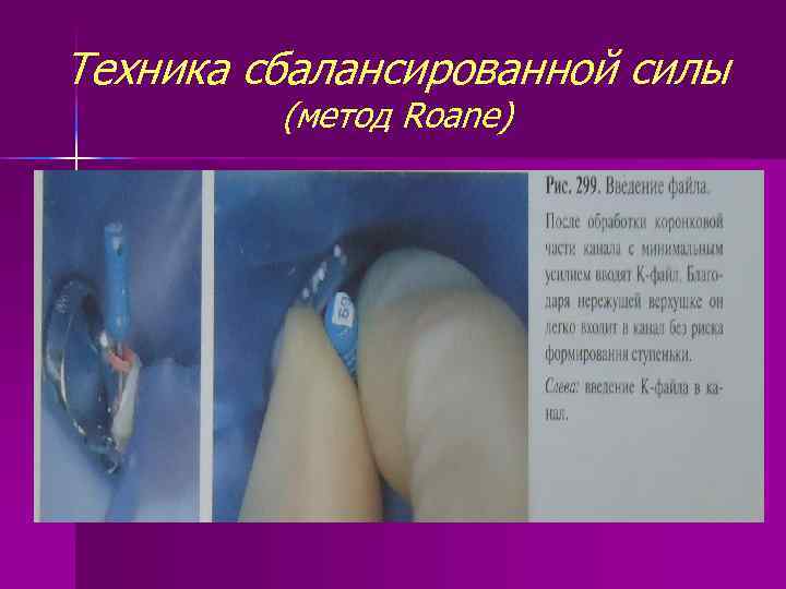 Техника сбалансированной силы (метод Roane) 