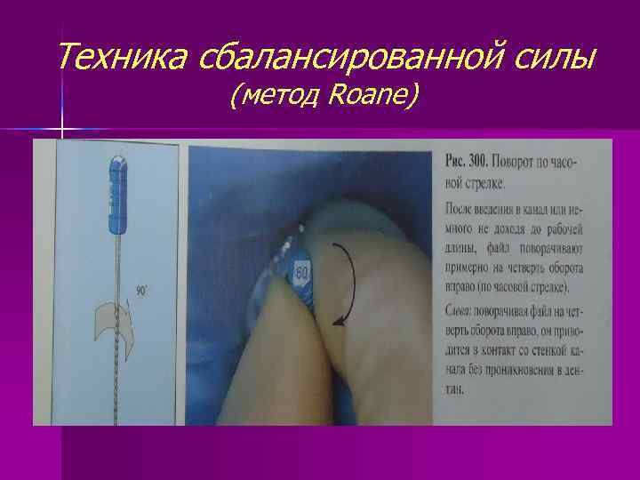 Техника сбалансированной силы (метод Roane) 