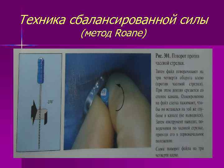 Техника сбалансированной силы (метод Roane) 